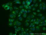 RCAS1 Antibody in Immunocytochemistry (ICC/IF)