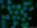Vitamin D binding protein Antibody in Immunocytochemistry (ICC/IF)