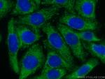 USP13 Antibody in Immunocytochemistry (ICC/IF)