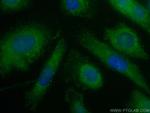 Zinc Alpha 2 Glycoprotein Antibody in Immunocytochemistry (ICC/IF)