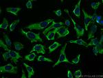 Septin 8 Antibody in Immunocytochemistry (ICC/IF)