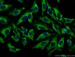Septin 8 Antibody in Immunocytochemistry (ICC/IF)