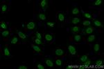 MCM2 Antibody in Immunocytochemistry (ICC/IF)