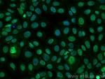 TLE1 Antibody in Immunocytochemistry (ICC/IF)