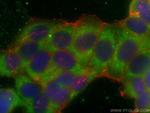 Mammaglobin A Antibody in Immunocytochemistry (ICC/IF)