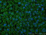 C4 Gamma Chain Antibody in Immunohistochemistry (Paraffin) (IHC (P))