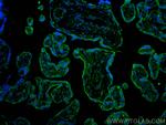 PD-L1/CD274 Antibody in Immunohistochemistry (PFA fixed) (IHC (PFA))