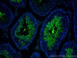 AKAP3 Antibody in Immunohistochemistry (PFA fixed) (IHC (PFA))
