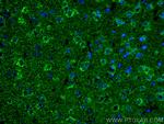 KGA Antibody in Immunohistochemistry (PFA fixed) (IHC (PFA))