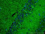 KGA Antibody in Immunohistochemistry (PFA fixed) (IHC (PFA))