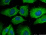 C1qC Antibody in Immunocytochemistry (ICC/IF)