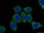 CLTCL1 Antibody in Immunocytochemistry (ICC/IF)