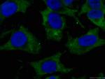 CDK6 Antibody in Immunocytochemistry (ICC/IF)