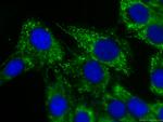 MYL3 Antibody in Immunocytochemistry (ICC/IF)