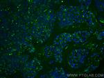 CD27 Antibody in Immunohistochemistry (PFA fixed) (IHC (PFA))