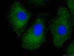 RSPO3 Antibody in Immunocytochemistry (ICC/IF)