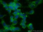 Peripherin Antibody in Immunocytochemistry (ICC/IF)