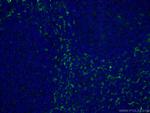 Fascin Antibody in Immunohistochemistry (PFA fixed) (IHC (PFA))