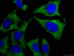 CAPRIN1 Antibody in Immunocytochemistry (ICC/IF)