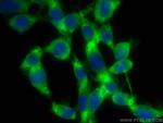 SKAP2 Antibody in Immunocytochemistry (ICC/IF)