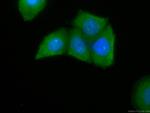 PKC alpha Antibody in Immunocytochemistry (ICC/IF)