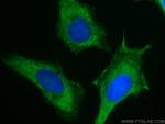 PKC alpha Antibody in Immunocytochemistry (ICC/IF)