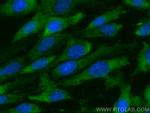 SPARC Antibody in Immunocytochemistry (ICC/IF)