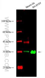 RGS4 Antibody in Western Blot (WB)