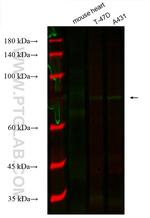 Gamma Catenin Antibody in Western Blot (WB)