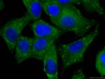 NRG1 Antibody in Immunocytochemistry (ICC/IF)
