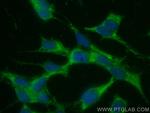 Calretinin Antibody in Immunocytochemistry (ICC/IF)