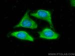 MDH1 Antibody in Immunocytochemistry (ICC/IF)
