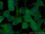 SP1 Antibody in Immunocytochemistry (ICC/IF)