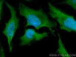USP7 Antibody in Immunocytochemistry (ICC/IF)