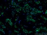 AMPK alpha Antibody in Immunohistochemistry (PFA fixed) (IHC (PFA))