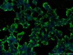 RYR1 Antibody in Immunocytochemistry (ICC/IF)