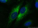 COX4NB Antibody in Immunocytochemistry (ICC/IF)