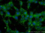 Huntingtin Antibody in Immunocytochemistry (ICC/IF)