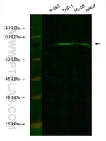 CIN85 Antibody in Western Blot (WB)