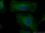 AMPK Beta 2 Antibody in Immunocytochemistry (ICC/IF)