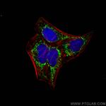 ATPB Antibody in Immunocytochemistry (ICC/IF)