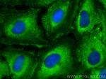 RABEPK/p40 Antibody in Immunocytochemistry (ICC/IF)