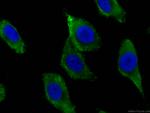 GSTA1 Antibody in Immunocytochemistry (ICC/IF)