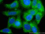 C5 Antibody in Immunocytochemistry (ICC/IF)