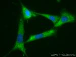 STK3 Antibody in Immunocytochemistry (ICC/IF)