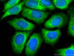 IGFBP2 Antibody in Immunocytochemistry (ICC/IF)