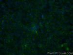 TLR2 Antibody in Immunocytochemistry (ICC/IF)