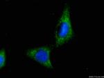 EIF4E Antibody in Immunocytochemistry (ICC/IF)