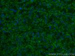 OCIAD1 Antibody in Immunohistochemistry (PFA fixed) (IHC (PFA))