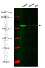 SYK Antibody in Western Blot (WB)